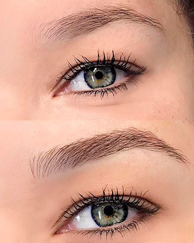 Sobrancelhas Antes e Depois